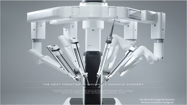 Robot assisted surgery for Gastrointestinal